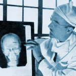 The Lobotomist