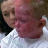 my skin is killing me